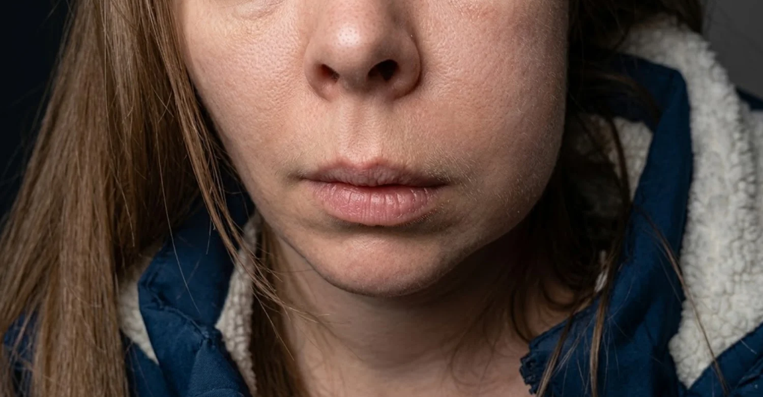 Prion Diseases and Oral Health inblog